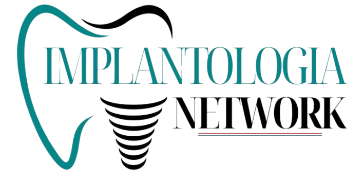 Implantologia Network &mdash; BSS + All-on-Full&trade; WIKI