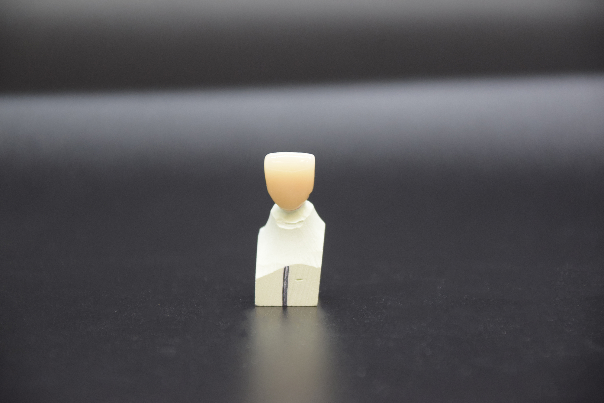 Corona in zirconia